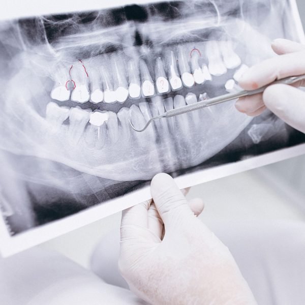 Radiología Dental